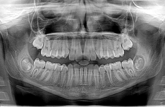 Protetyka stomatologiczna