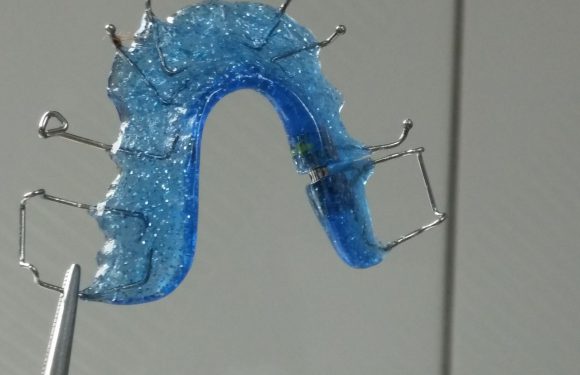 Proteza na implantach – czy to się opłaca?