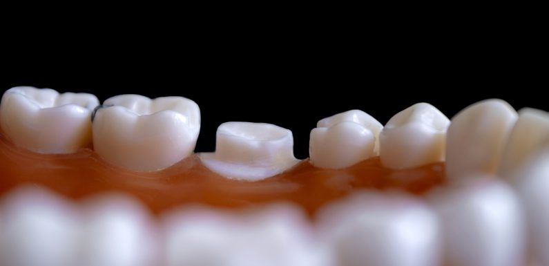 Protetyka sosnowiec – rodzaje protez zębowych