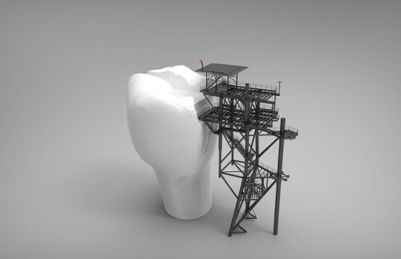 Implanty zębów na Śląsku