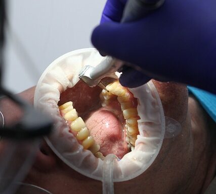 Chirurgia stomatologiczna a ortodoncja: Przygotowanie do leczenia ortodontycznego