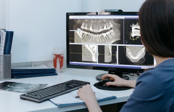 RTG panoramiczne a diagnostyka schorzeń przyzębia: Zastosowanie w identyfikacji chorób dziąseł