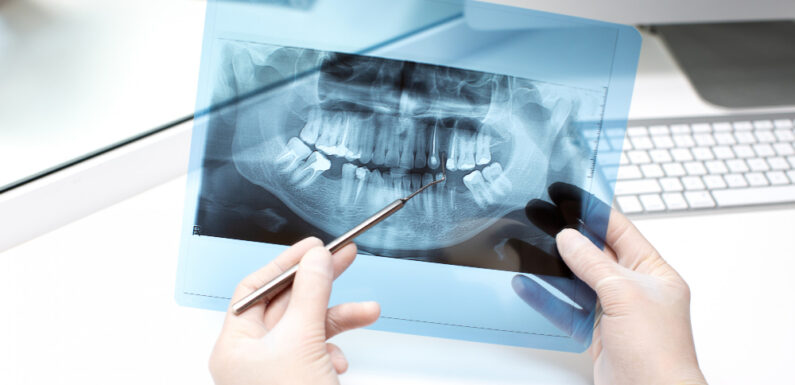 RTG zębów a wykrywanie ukrytych problemów – co może ujawnić RTG?