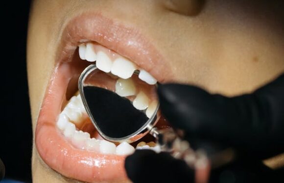 Czy implanty zębowe są trwałym rozwiązaniem?