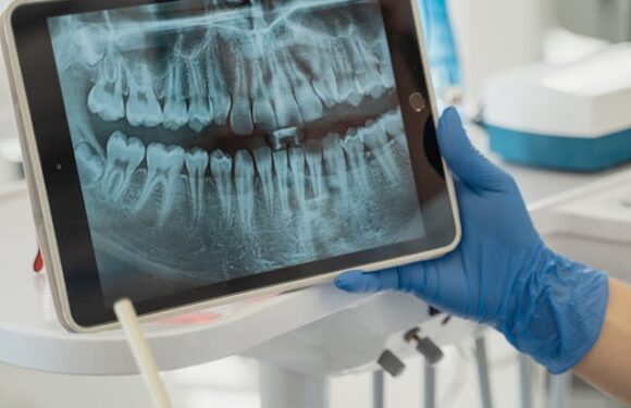 RTG zębów a promieniowanie: Co warto wiedzieć?