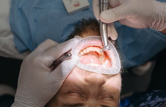 Fluoroza – Czym jest? Skąd się bierze? Jakie ją leczyć?