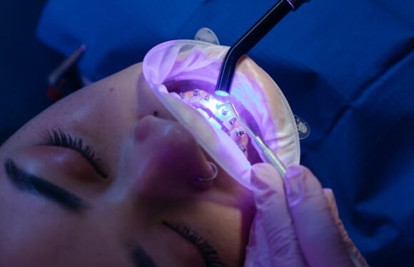 Czy aparat prostuje zęby na stałe?