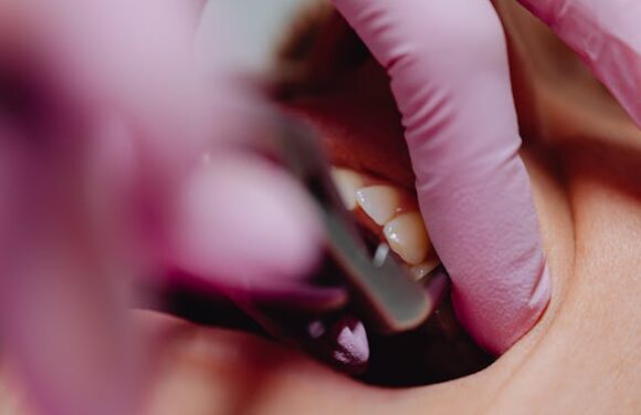 Czy odsłonięte szyjki zębowe mogą się cofnąć?