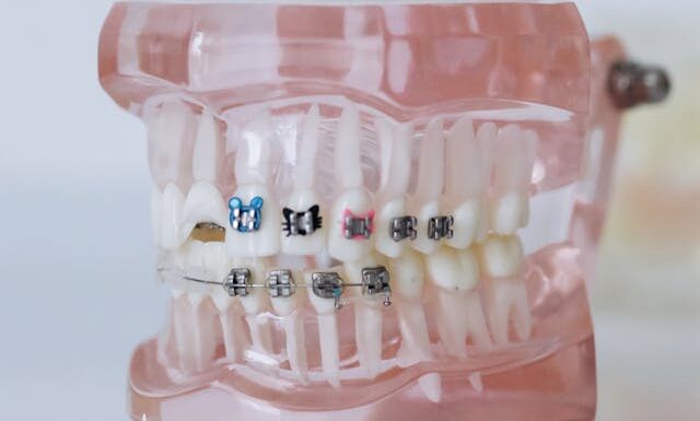 Czy leczenie ortodontyczne poprawia wymowę?