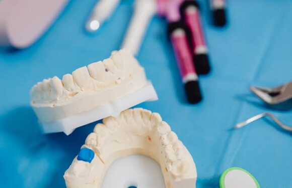 Jak wygląda wycisk protetyczny podczas wizyty u protetyka?