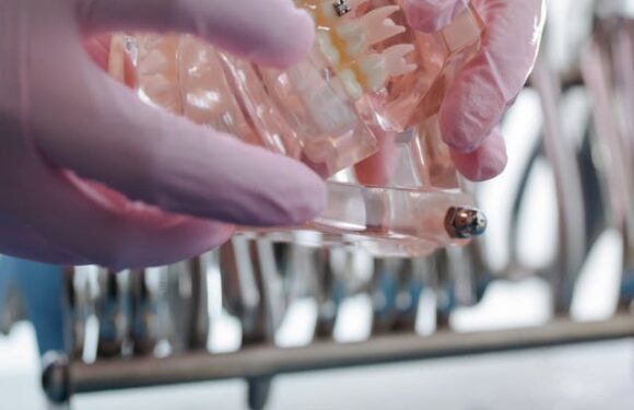 Retencja po leczeniu ortodontycznym – dlaczego jest niezbędna?
