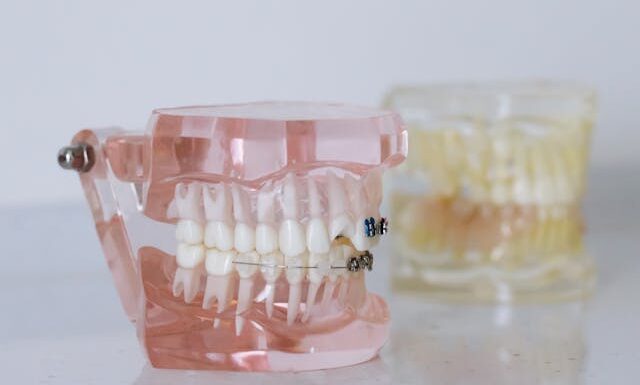 Czy protezy ruchome acetalowe przebarwiają się z czasem?