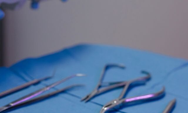 Od czego zależy liczba wizyt u endodonty?